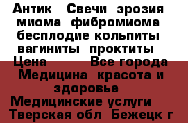 Антик.  Свечи (эрозия, миома, фибромиома, бесплодие,кольпиты, вагиниты, проктиты › Цена ­ 550 - Все города Медицина, красота и здоровье » Медицинские услуги   . Тверская обл.,Бежецк г.